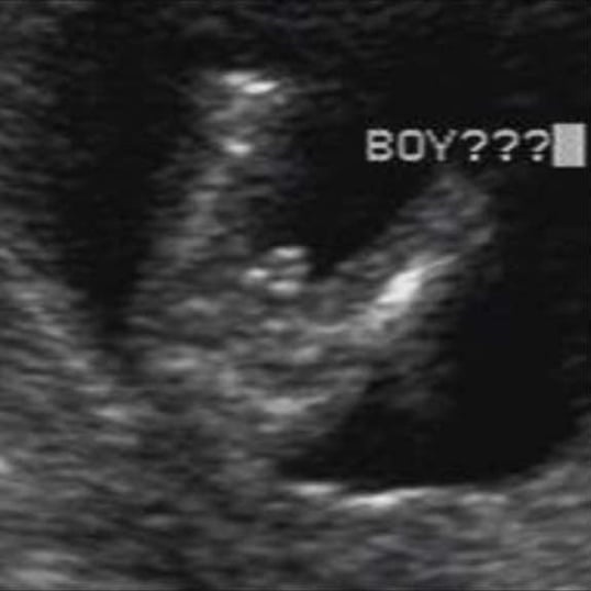 Fetal Anomaly Scan Dubai Gynaecology Clinic